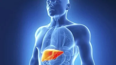 Fatty Liver 5